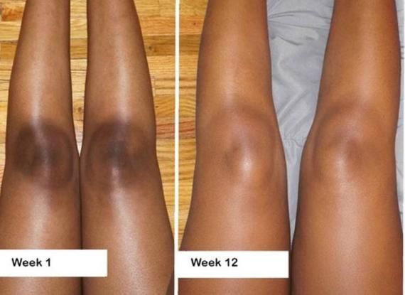 Super Glow Full Face & Body Deal 7