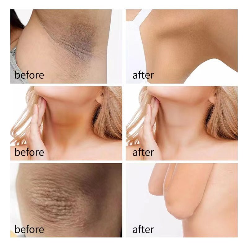 Arm Fair Brightening Cream - Glammzi