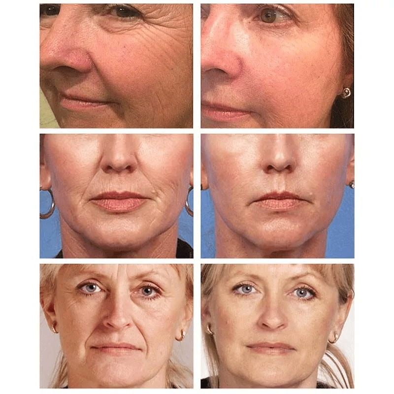 Urgent Facial Careem - Glammzi