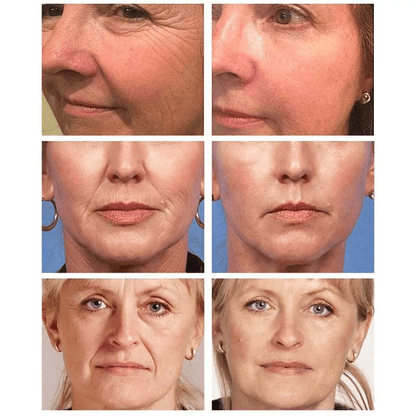 Urgent Facial Careem - Glammzi